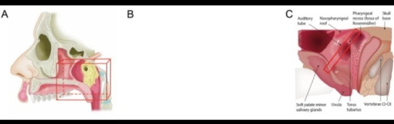 17068716337795.png